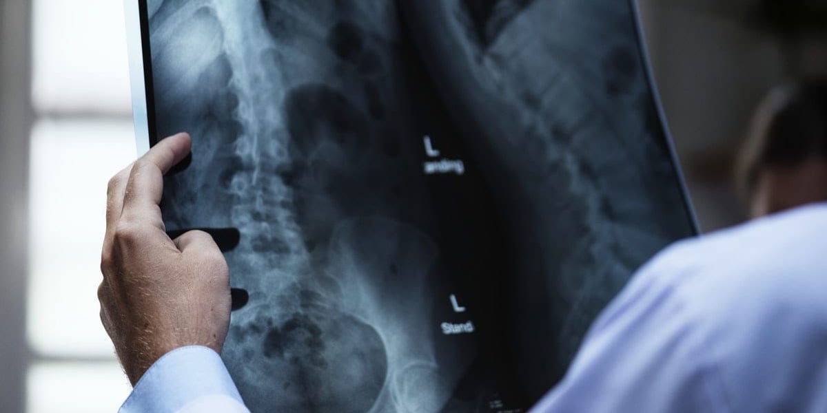 Disc Injury in back