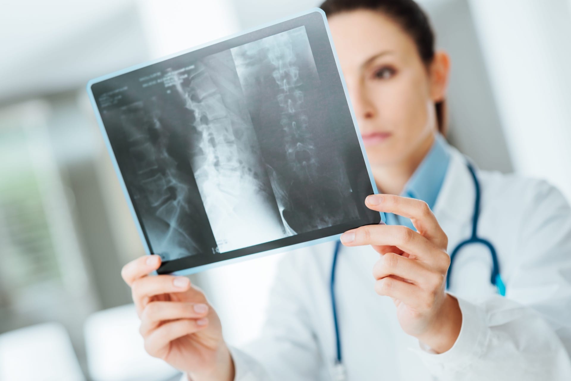 Spine Fracture Treatment Florida